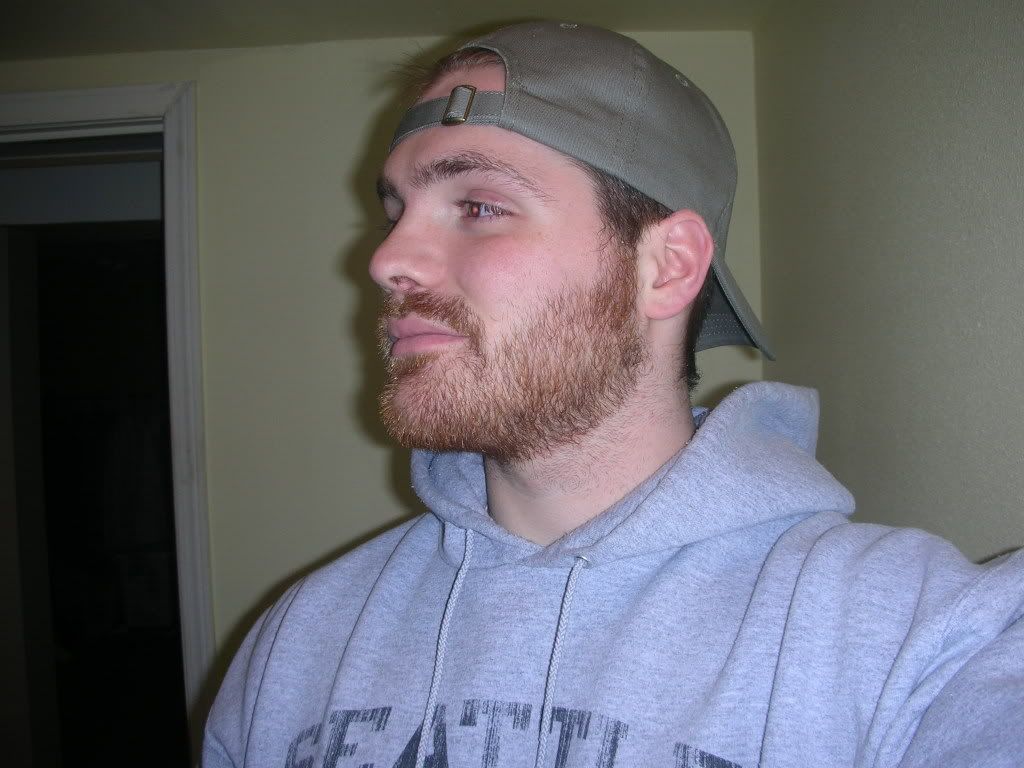 Beard 2 Weeks
